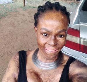 Afrique du sud: Un homme brule sa femme et sa fille à l'aide d’essence